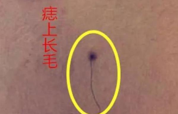 老人说两眼中间有痣好 两眼中间有痣情感运势顺畅 老人说两眼中间有痣好 两眼中间有痣情感运势顺畅