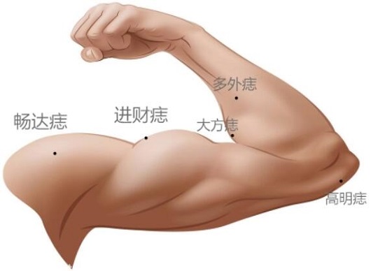 耳朵痣十大福气痣 女人10处有痣是富贵痣 耳朵痣十大福气痣 女人10处有痣是富贵痣